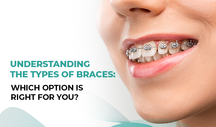 Understanding Braces and Their Vulnerability